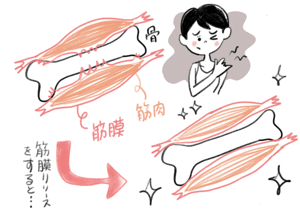 筋膜リリース